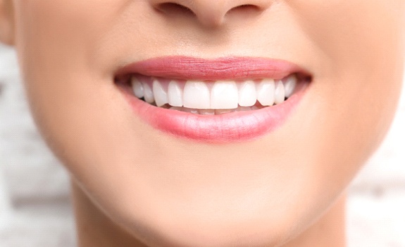 Closeup of woman with dental bonding in Rockwall smiling
