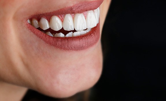 Close-up of woman’s smile with attractive teeth and gums