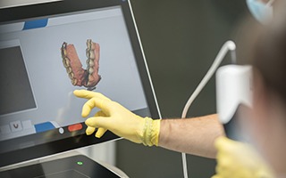 Dentist pointing to digital impressions