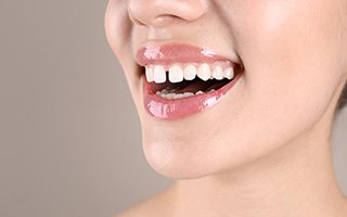 Nose-to-chin ¾ profile of a woman smiling with a diastema 