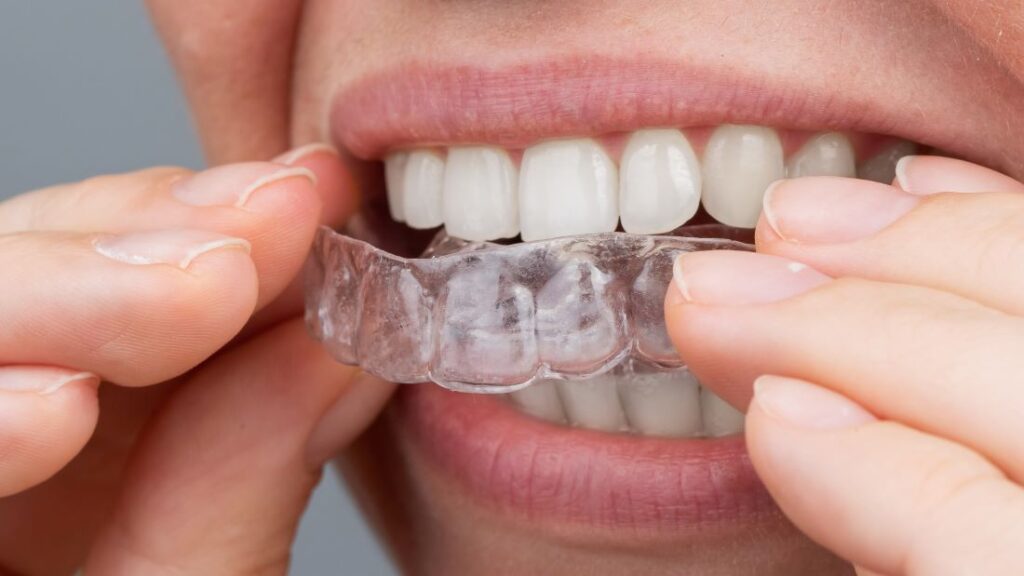 A woman putting on an Invisalign aligner.